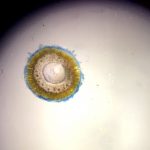 Nouvelle larve de méduse