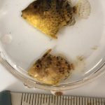 Zoom sur les balistes